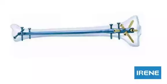 ortomare traumatologia.