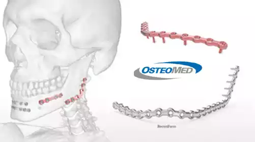 ortomare traumatologia.